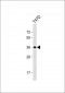 OR4D11 Antibody (C-term)